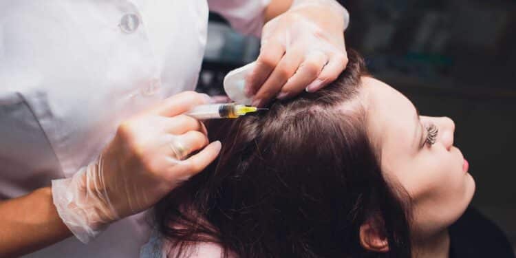 haartransplantatie kosten 3